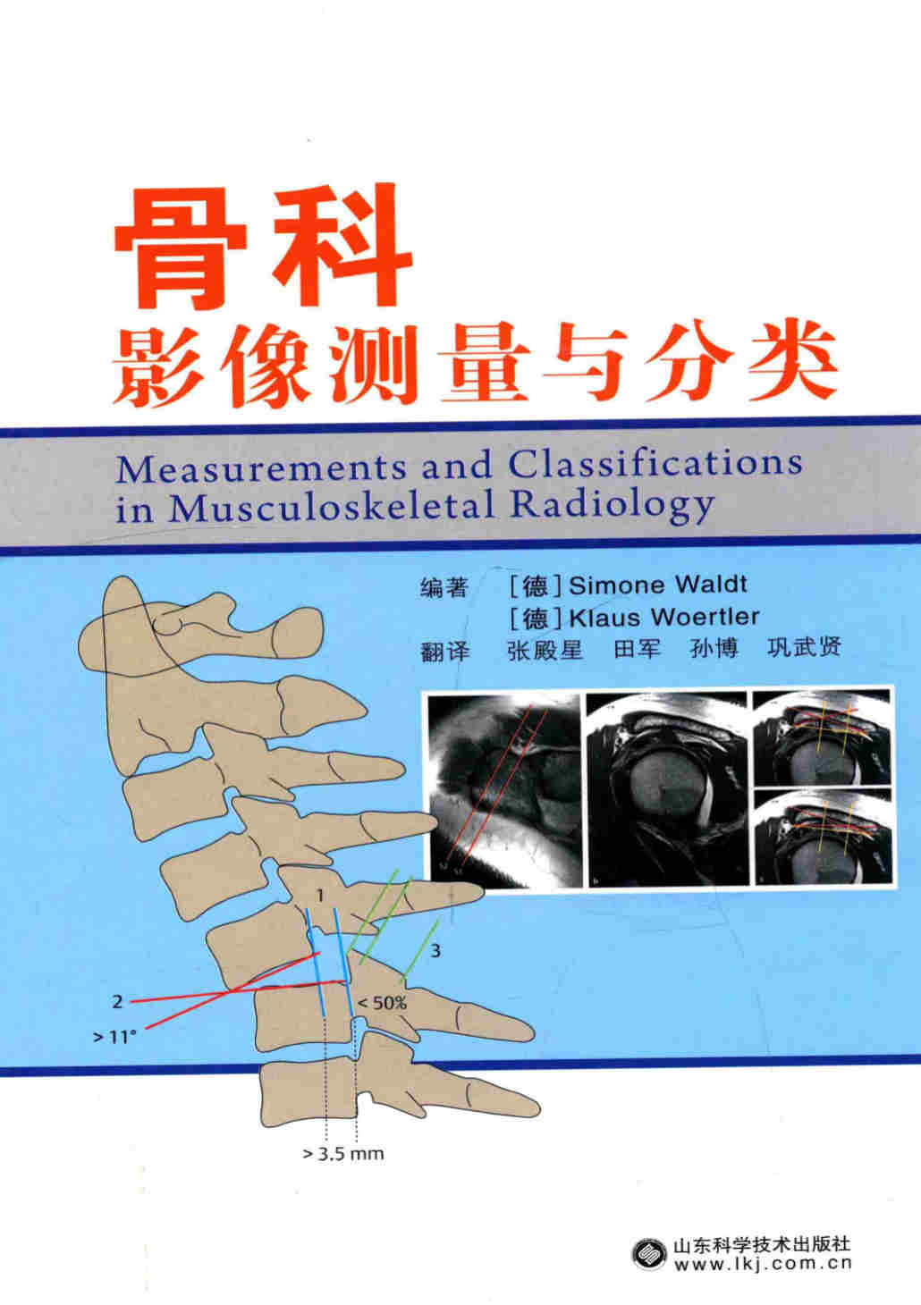 《骨科影像测量与分类》[德] 西蒙·瓦尔特  扫描版_PDF电子书_下载
